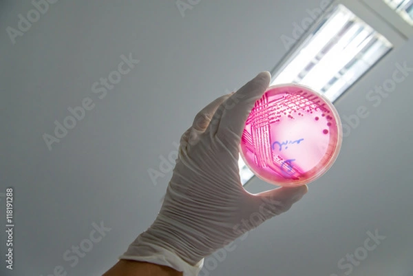 Fototapeta A microbiologist holds up an MacConkey agar plate containing Enterohemorrhagic Escherichia coli (EHEC), a foodborne pathogen that causes severe diarrhea, against the light for identification.