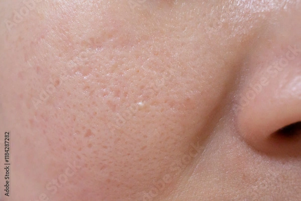 Obraz 팔자주름과 볼 모공