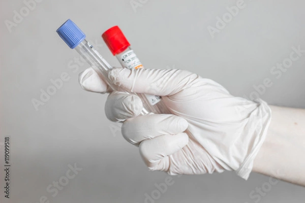 Fototapeta tubes for blood sampling