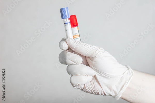 Fototapeta tubes for blood sampling