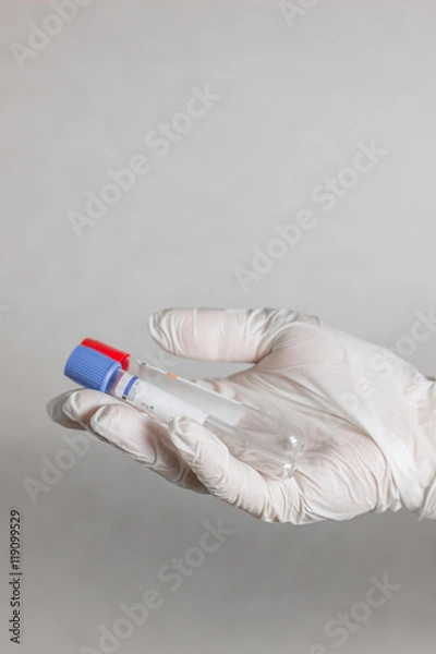 Fototapeta tubes for blood sampling