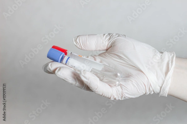 Fototapeta tubes for blood sampling