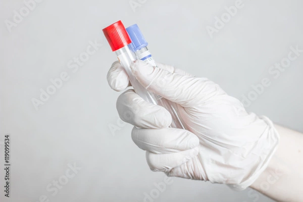 Fototapeta tubes for blood sampling