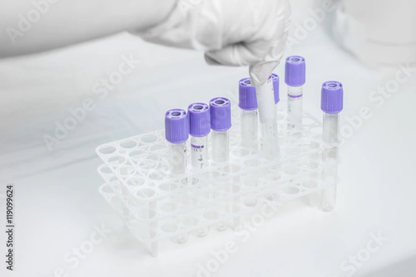 Fototapeta tubes for blood sampling