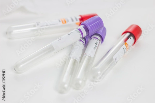 Fototapeta tubes for blood sampling