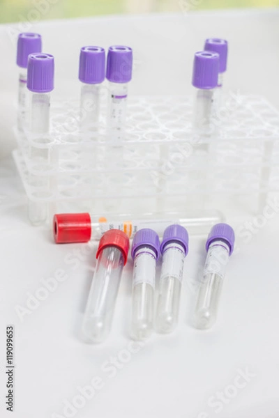 Fototapeta tubes for blood sampling