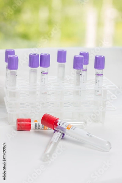 Fototapeta tubes for blood sampling