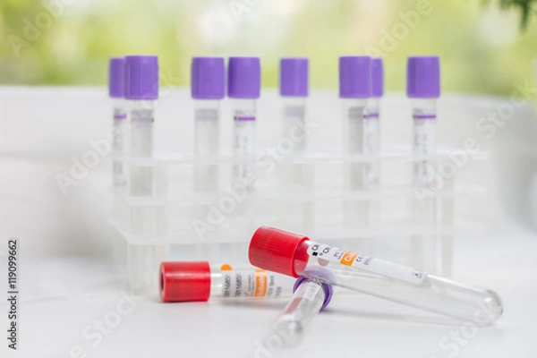 Fototapeta tubes for blood sampling