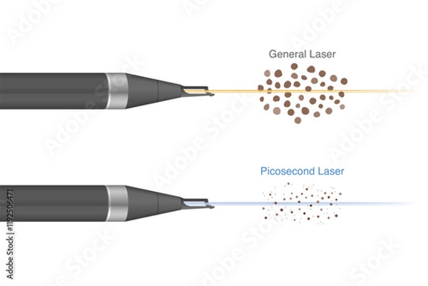 Fototapeta Difference of normal laser and Pico laser when shooting for breaks a dark spots on human skin layer into smaller fragments.