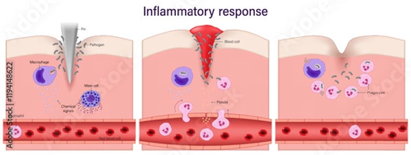 Fototapeta Inflammatory response. Process of inflammation. phagocytosis. Blood clotting.