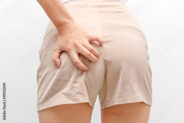 Fototapeta Buttocks itching