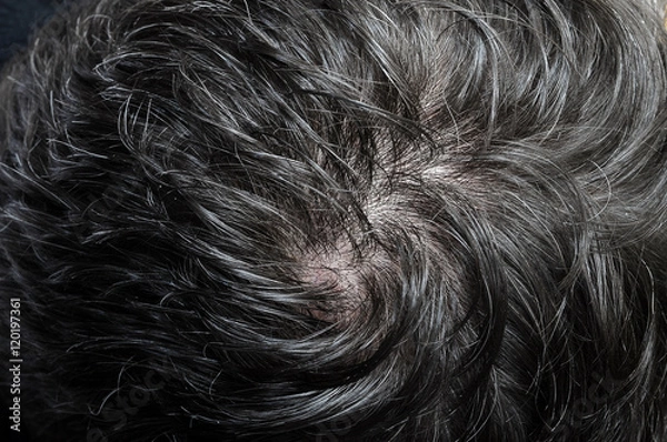 Fototapeta Macro of black hairs
