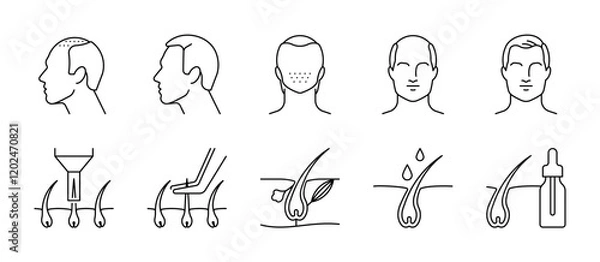 Obraz Hair grafts. Hair transplantation issue, icon set - bald man, bald head, baldness, follicle, extraction, implanter pen, growth, hair serum. Linear illustration, editable stroke icon