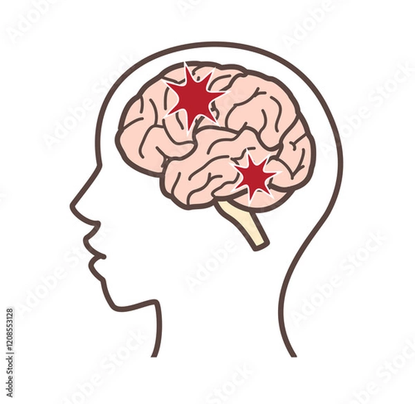 Obraz ダメージを受けた脳のイラスト