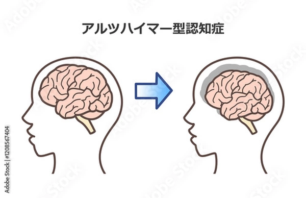 Obraz 脳のイラスト