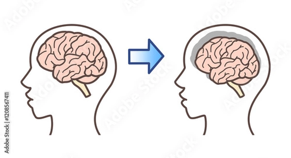 Obraz 脳のイラスト