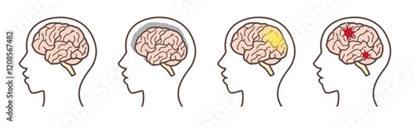 Obraz 脳のイラスト