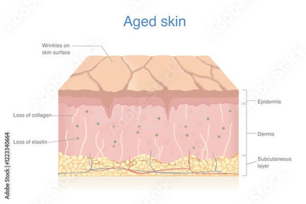 Fototapeta Aged skin layer isolated on white. Wrinkles and dryness on skin surface. Loss of collagen and elastin.  Skin problems in epidermis and dermis from aging.