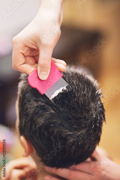 Obraz  Treatment for lice