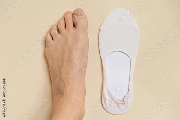 Fototapeta foot with ingrown nail and insole in the background. Concept of ingrown nail, onychocryptosis. Non-surgical correction of ingrown nail, Podofix correction systems