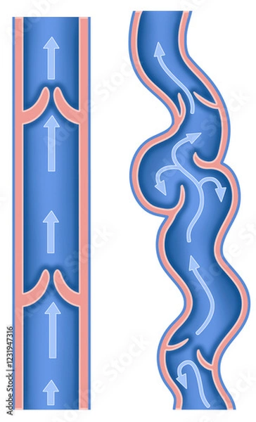 Fototapeta Schematic representation of varicose veins. We can see that they are dilated and tortuous veins, causing pain, swelling, and heaviness in the legs.