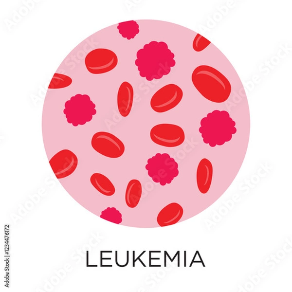 Obraz Vector Leukemia Icon
