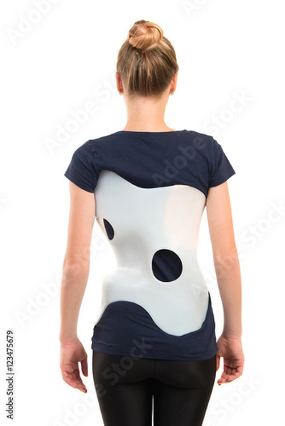 Fototapeta teenage patient in a corset Chenault isolated on white backgroun