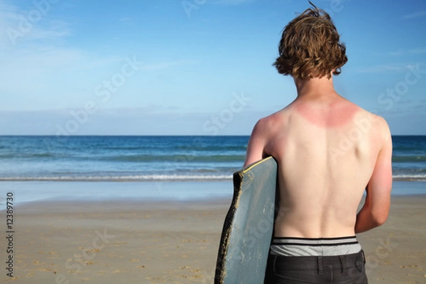 Obraz Spalony słońcem surfer.