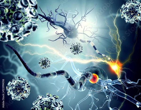 Fototapeta Damaged nerve cells, concept for neurodegenerative and neurological disease, tumors, brain surgery.