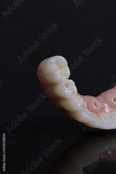 Obraz dental prosthesis veneers implant
