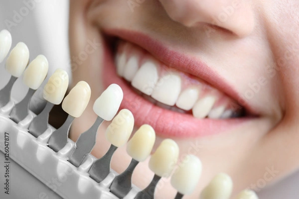 Obraz Młoda kobieta wybiera kolor zębów u dentysty, zbliżenie
