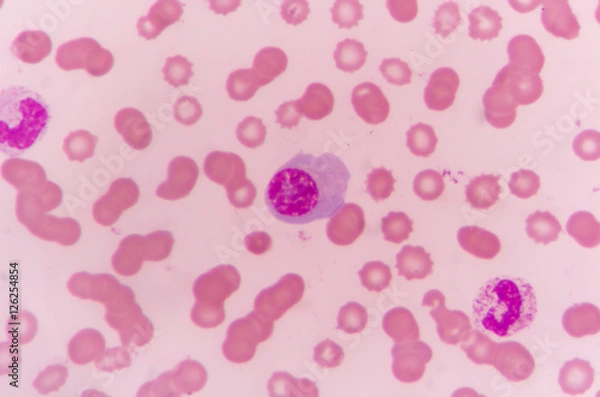 Obraz plasma cell human blood cell under microscope,complete blood count.