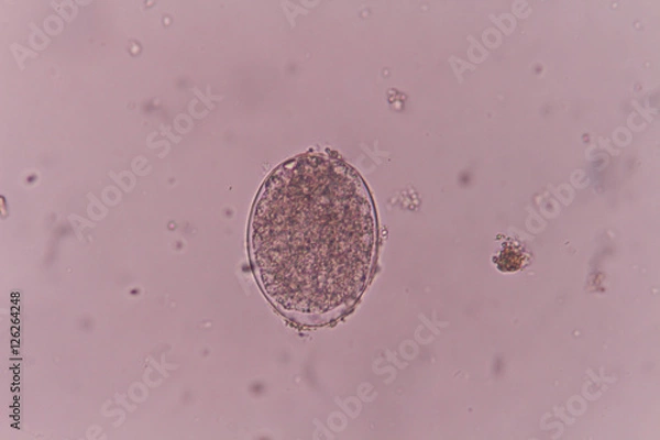 Obraz Hookworm egg under light microscopy
