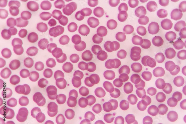 Obraz Normal red blood cells Under the microscope