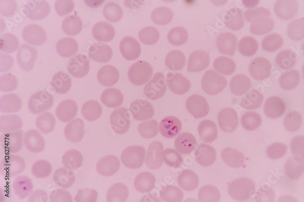 Obraz plasmodium falciparum krwinki czerwone