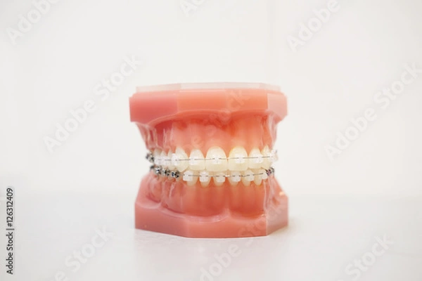Fototapeta The image of a denture