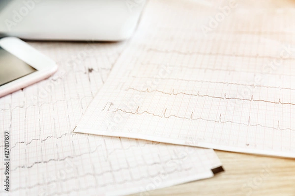 Obraz Electrocardiogram