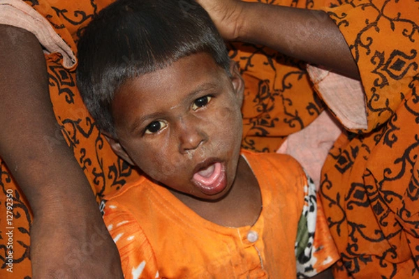 Obraz Coughing Poor Girl