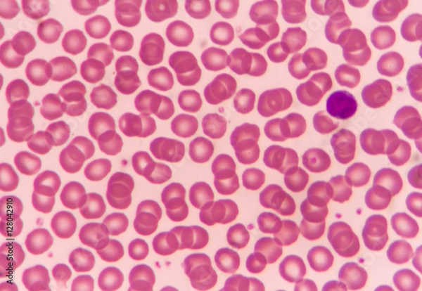Obraz Normal red blood cells
