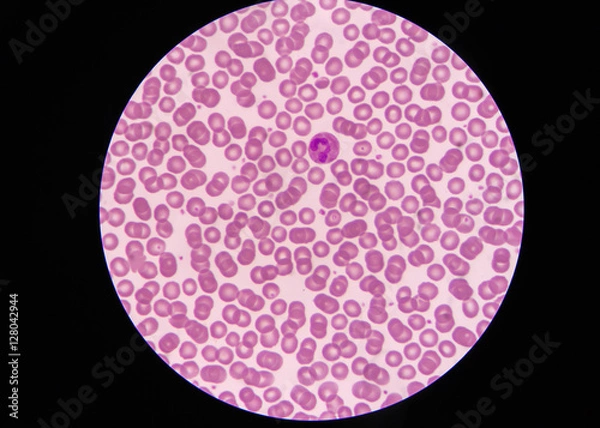 Obraz Normal red blood cells Under the microscope