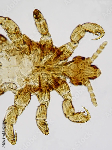 Fototapeta head lice