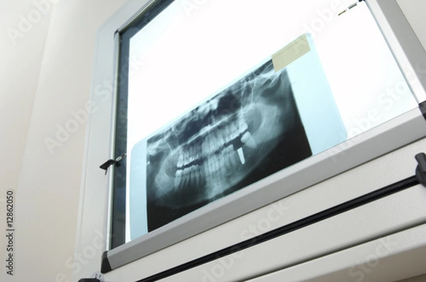 Fototapeta Röntgen 2