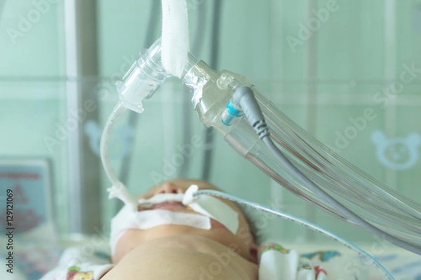 Obraz Noworodek na maszynie do oddychania lub respiratorze z rurką ustno-żołądkową