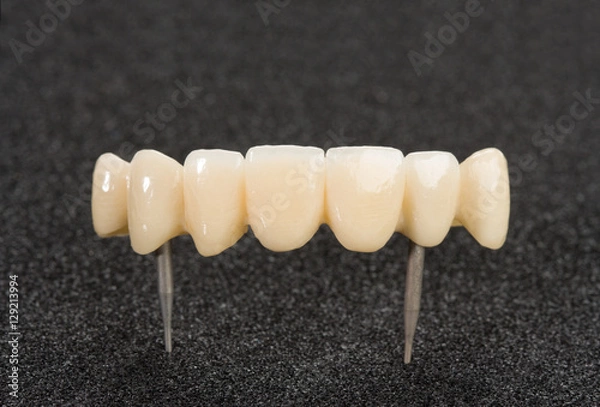 Obraz Crown seven elements on zirconium oxide, detail of the layering ceramic dental implant.