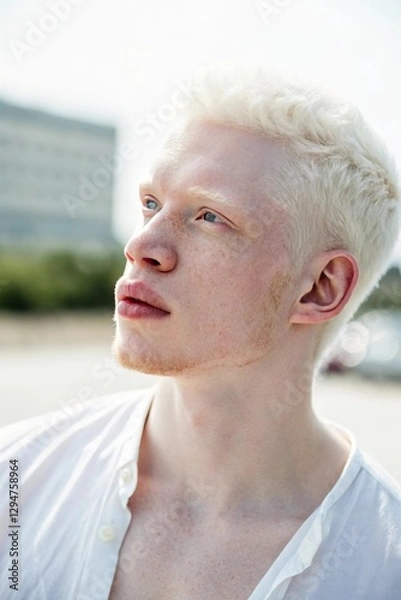Obraz A beautiful young man with albinism, featuring fair skin, white hair, and delicate features. He looks confident and serene, with soft natural lighting highlighting her unique beauty