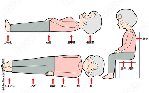 Obraz 床ずれ位置