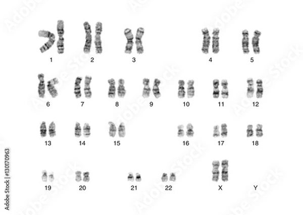 Obraz Chromosome