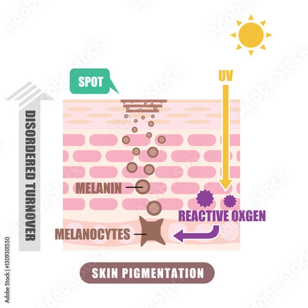 Fototapeta 肌断面図で見せるシミのイラスト
