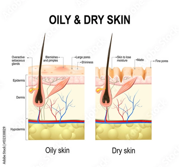 Fototapeta Skóra tłusta i sucha