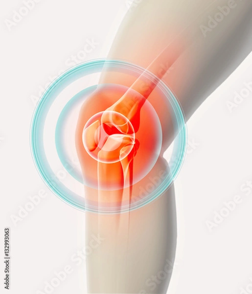 Obraz Knee painful - skeleton x-ray.